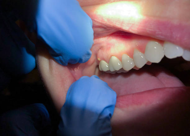 Best Mobile Emergency Dentist in Brighton, MI