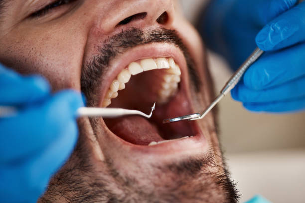 Best Emergency Dentist for Knocked-Out Tooth in Brighton, MI